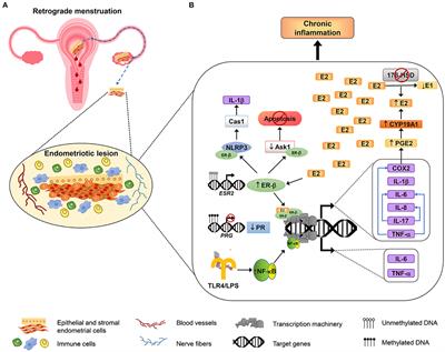 Regulation of Inflammation Pathways and Inflammasome by Sex Steroid Hormones in Endometriosis